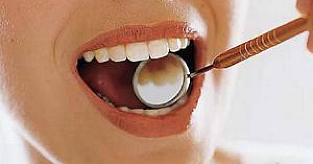 O benefício do canabidiol para os dentes, segundo...